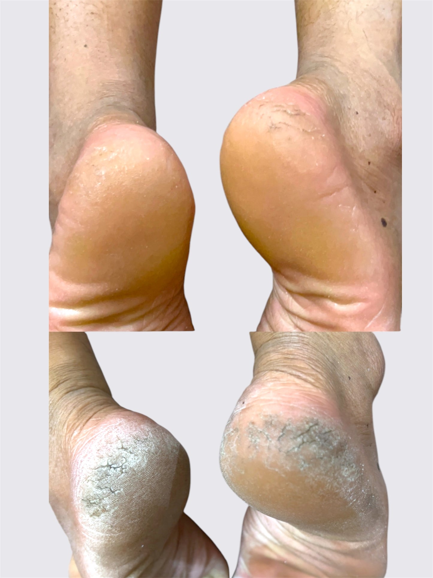 Foot Fizz